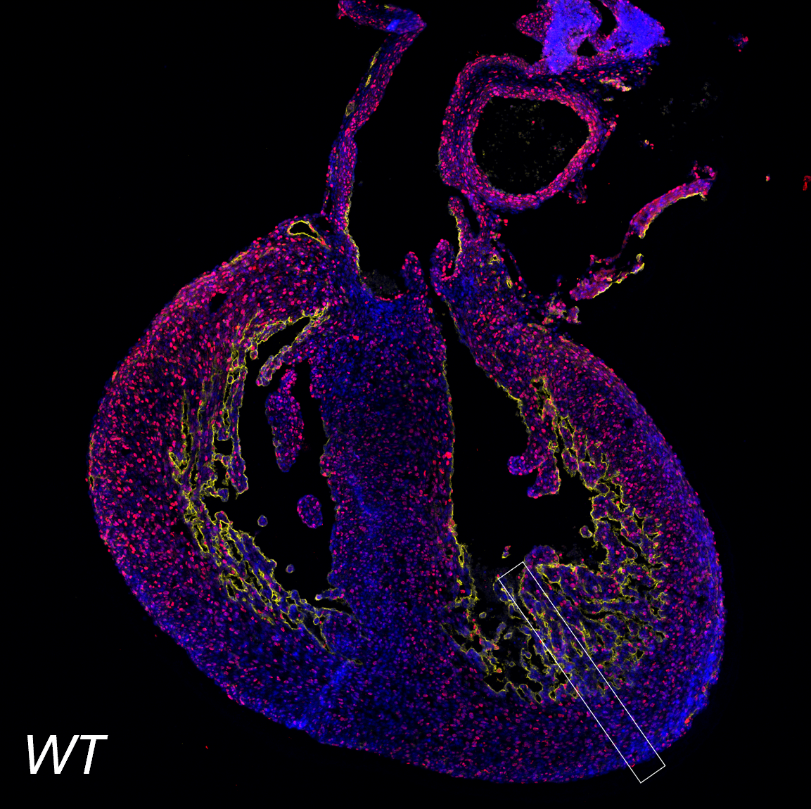 Foci of UCP1-positive adipocytes (red) in the inguinal adipose tissue of mice exposed to cold